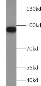 VPS35 antibody - image 1