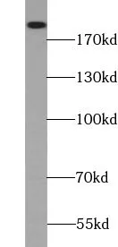 TSC2 antibody - image 1