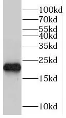 TRAPPC4 antibody - image 1