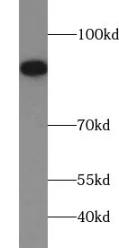 UBA2 antibody - image 1
