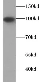 USP5 antibody - image 1
