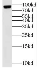 TNFAIP3 antibody - image 1