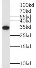 TRA2A antibody - image 1