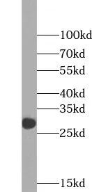 WDR4 antibody - image 1