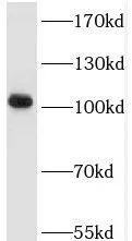 TRAK2 antibody - image 2