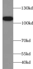TROAP antibody - image 1