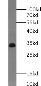 UCK2 antibody - image 1