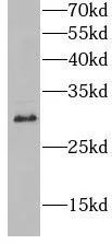 HLA-DQB1 antibody - image 1