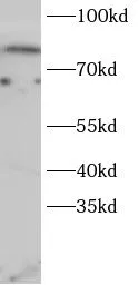 FOXO1 antibody - image 1