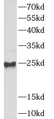 UBE2S antibody - image 2