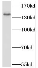 KIT antibody - image 2