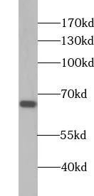 ZNF512 antibody - image 1