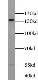 TRPS1 antibody - image 1
