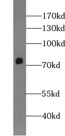 ZNF549 antibody - image 1