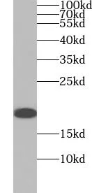 BIRC5 antibody - image 1