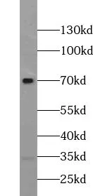 TRPV6 antibody - image 1