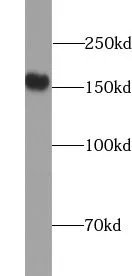 VLDLR antibody - image 1