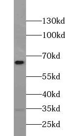 UBXN4 antibody - image 2
