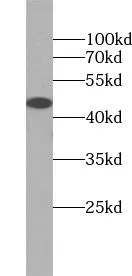 TRIM39 antibody - image 1