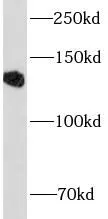 CD22 antibody - image 1