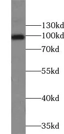 TSHZ3 antibody - image 1