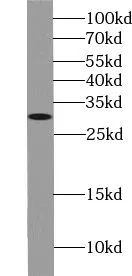 USE1 antibody - image 1