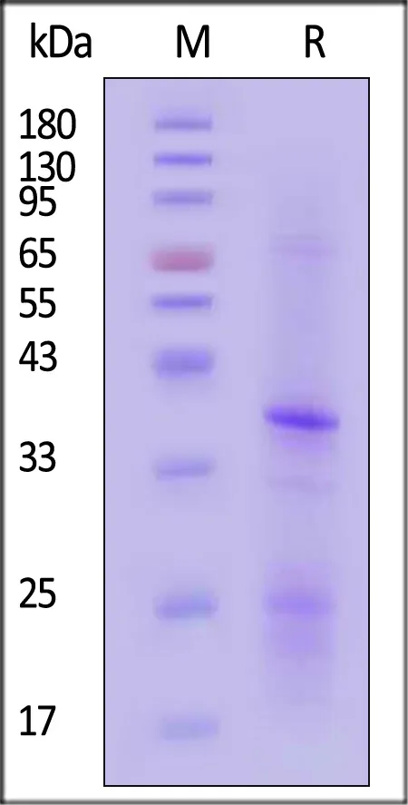 FITC-Labeled Human CD20 / MS4A1 Full Length Protein, His Tag (Nanodisc, SPR verified) - image 1