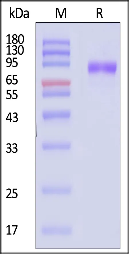 Mouse GUCY2C / Guanylyl cyclase C Protein, His Tag (MALS verified) - image 1
