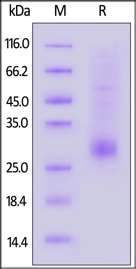 Human TL1A / TNFSF15 Protein, His Tag - image 1
