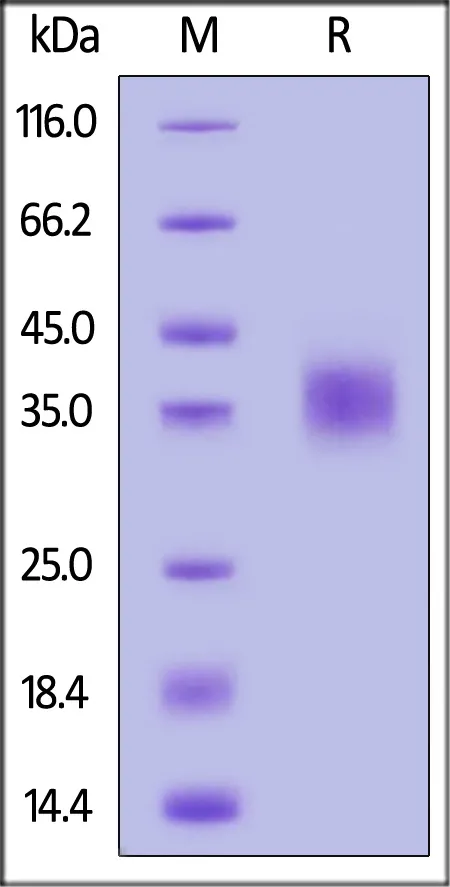 Human CD47 Protein, His Tag (MALS verified) - image 1