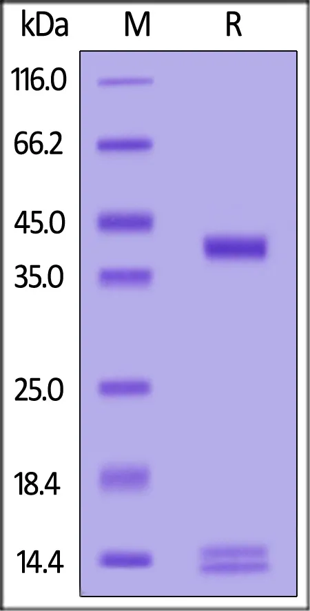 Human HLA-A*02:01&B2M&NY-ESO-1 (SLLMWITQV) Tetramer Protein (MALS verified) - image 1