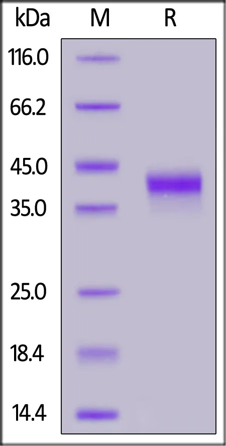 Biotinylated Human IGF-I Protein, Avitag™,Fc Tag (MALS verified) - image 1