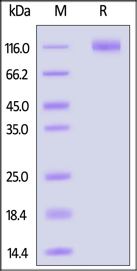 SARS-CoV-2 Spike S1 Protein, His Tag (BA.2.75/Omicron) - image 1