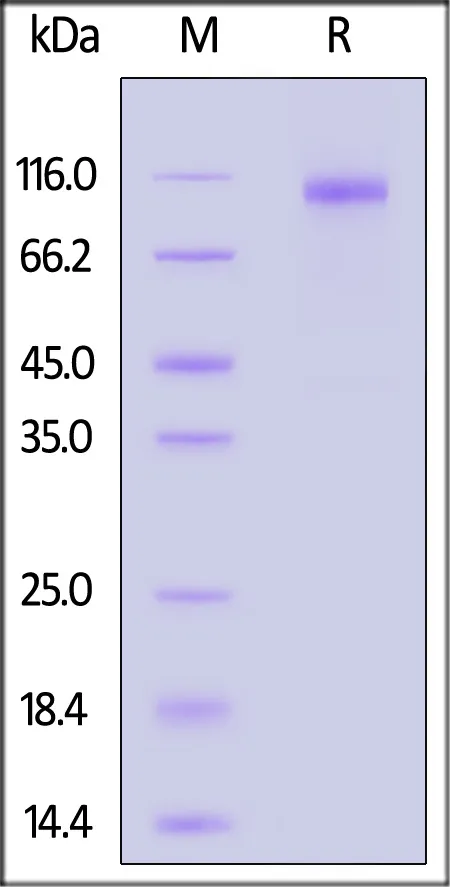 SARS-CoV-2 Spike S1 Protein, His Tag (BA.4 & BA.5/Omicron) - image 1