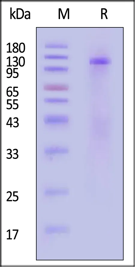 Cat Insulin R / CD220 (28-956) Protein, His Tag (HPLC verified) - image 1
