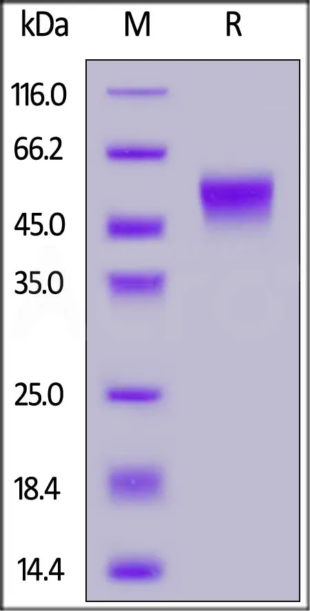 Human Fc gamma RIIIB / CD16b (NA2) Protein, SUMO,His Tag (MALS & BLI-verified) - image 1