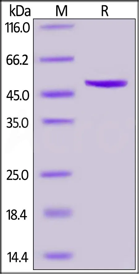 SARS-CoV-2 (COVID-19) Nucleocapsid protein, His Tag - image 1