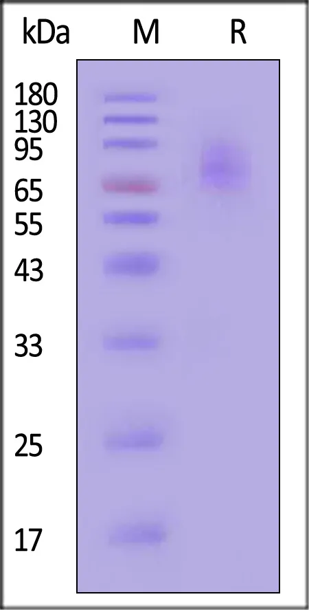 Human IL-4 R alpha & IL-13 R alpha 1 Protein, Fc Tag&Fc Tag (MALS verified) - image 1