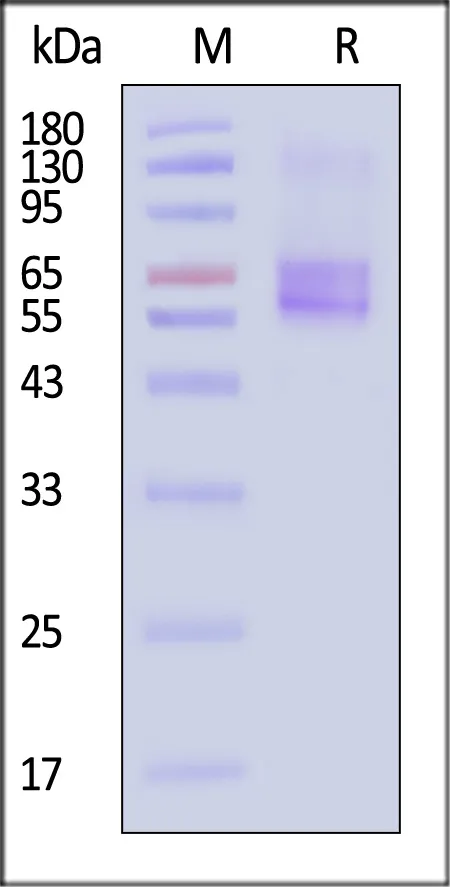 Human SLC1A2 Protein, Flag,His Tag (Detergent) - image 1