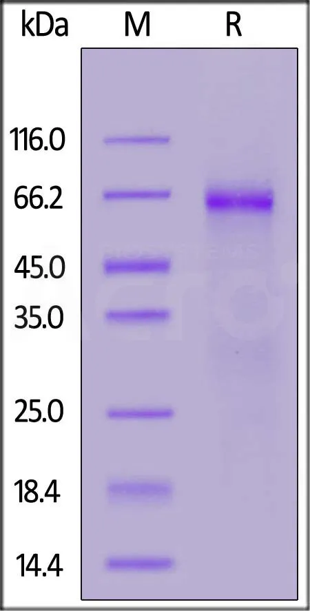 SARS-CoV-2 Nucleocapsid protein (P80R), His Tag - image 1