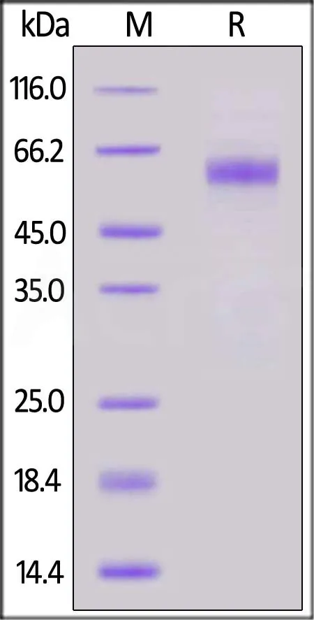 SARS-CoV-2 Nucleocapsid protein (D63G, R203M, D377Y), His Tag - image 1