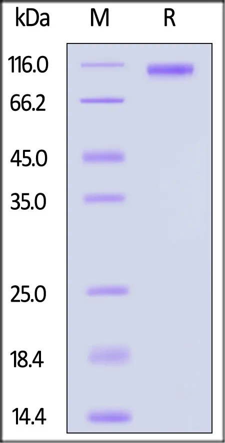 SARS-CoV-2 Spike S1 Protein, His Tag (BA.2.12.1/Omicron) - image 1