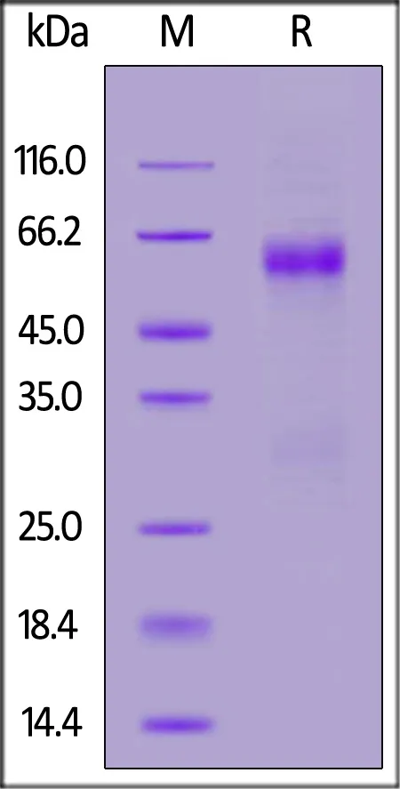 SARS-CoV-2 (COVID-19) Nucleocapsid protein, His Tag - image 1