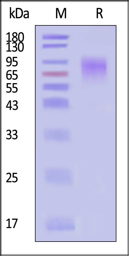 Nipah virus Glycoprotein G, His Tag (MALS verified) - image 1