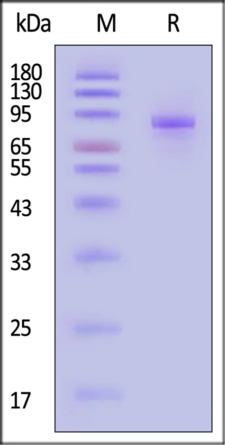 Biotinylated Human SLITRK6 protein, His,Avitag™ - image 1