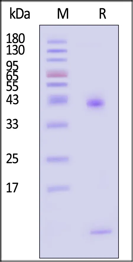 Biotinylated Human HLA-A*02:01&B2M&HER2 (KIFGSLAFL) Complex Protein (Monomer, MALS verified) - image 1