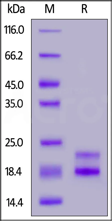 Rabbit CD3 epsilon&CD3 gamma Heterodimer Protein, His Tag&Flag Tag (MALS verified) - image 1