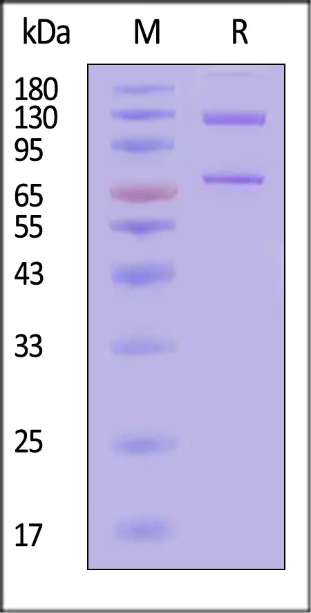 Biotinylated Cynomolgus Complement C5 Protein, His,Avitag™ (MALS verified) - image 1