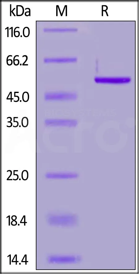 SARS-CoV-2 (COVID-19) Nucleocapsid protein, His Tag - image 1