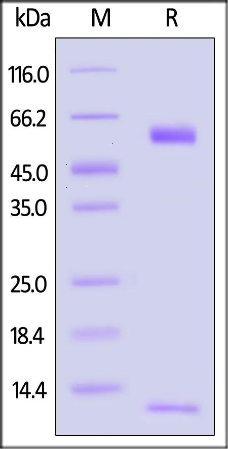 Alexa Fluor™ 488-Labeled Human HLA-A*11:01&B2M&KRASG12D (VVGADGVGK) Complex Protein (Monomer) - image 1